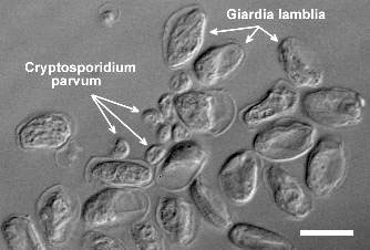 quistes de giardia en heces